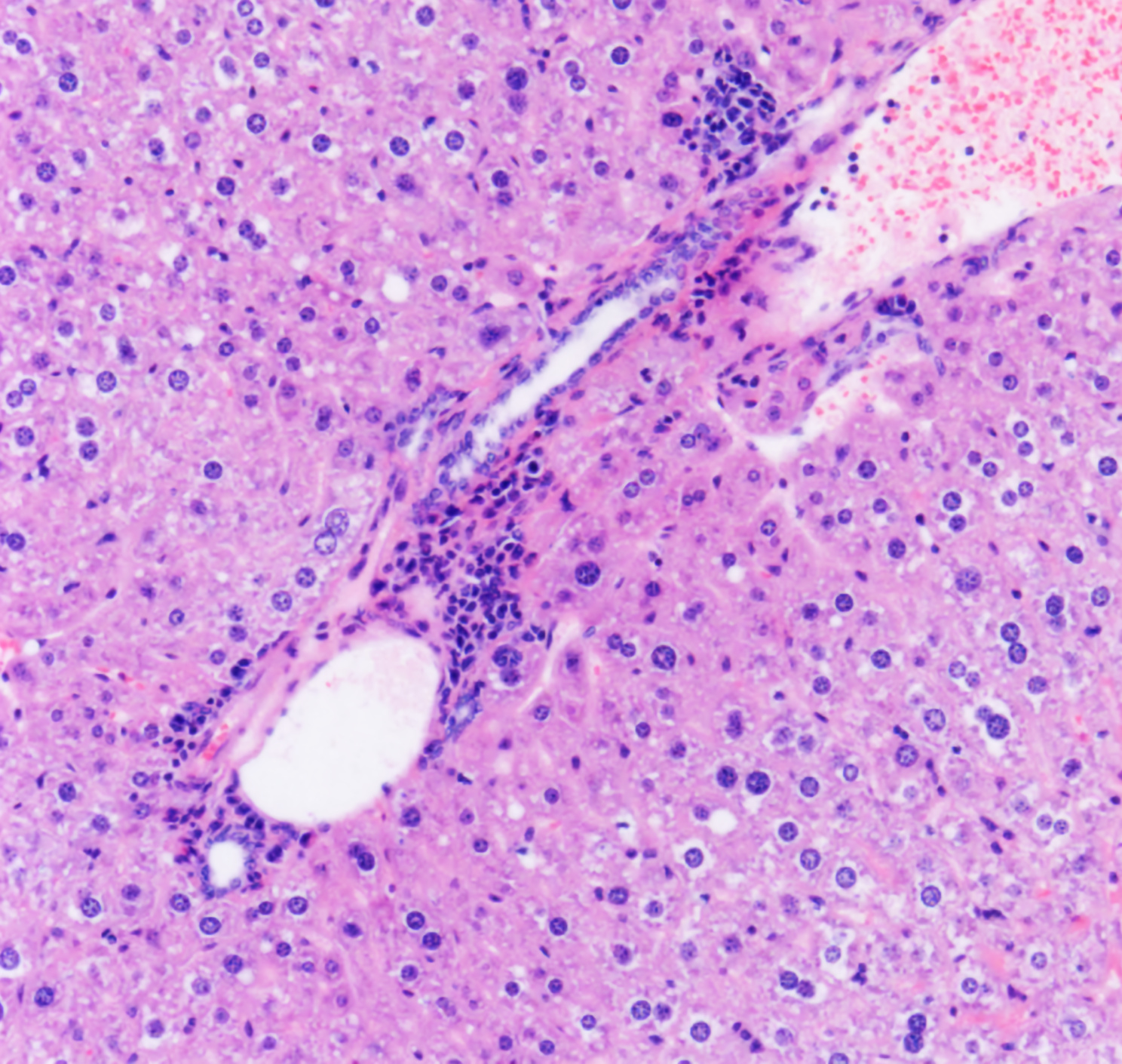 A microscope image of an aged mouse liver showing signs of chronic inflammation