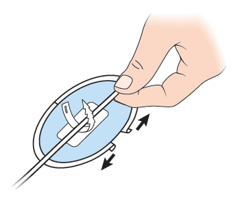 Figure 10. Removing the backing paper of the CathGrip