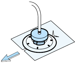 Figure 7. Sliding the Telfa under the disk, around the catheter