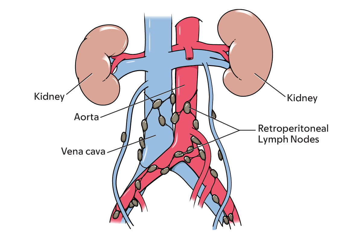 retroperitoneal lymph nodes