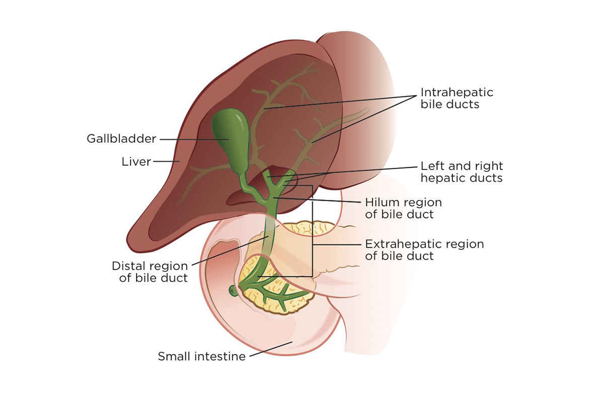 symptoms of bile duct cancer