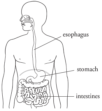 Barrett's Esophagus | Memorial Sloan Kettering Cancer Center