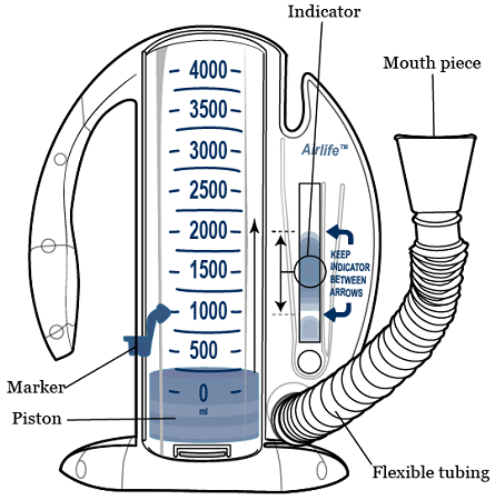 How to Use Your Incentive Spirometer | Memorial Sloan Kettering Cancer