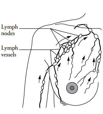 sentinel lymph node meaning