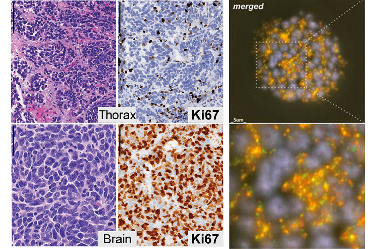 scientific images from lung cancer study