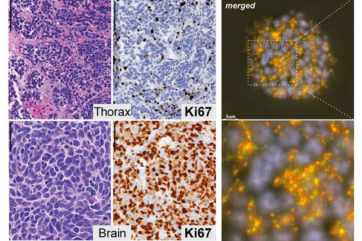 pathology images