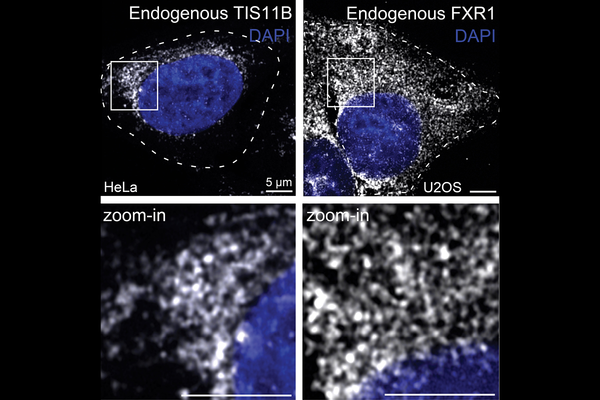 the relationship between mRNAs and intrinsically disordered regions (IDRs)