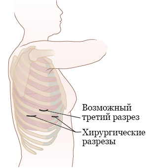 Рисунок 2.&nbsp; Места разрезов