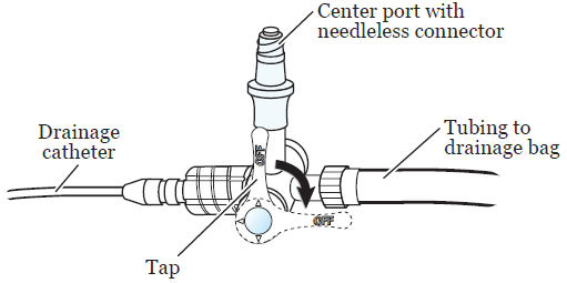 About Your Sutured Drainage Catheter Memorial Sloan Kettering Cancer 