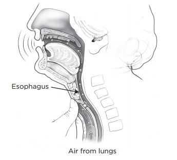 About Your Total Laryngectomy | Memorial Sloan Kettering Cancer Center