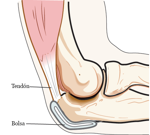 Figura 1. Bursitis