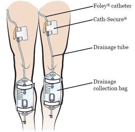 Mua Cathwear Catheter Leg Bag Underwear - Leg Bag Holder for Men & Women|  Medicare Approved -Compatible with Foley, Nephrostomy, Suprapubic & Biliary  Catheters Holds (2) 600ml Leg Bags| Black| Medium trên
