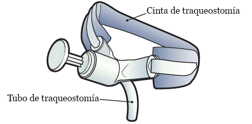 Figura 2. Tubo y cinta de sujeción de traqueostomía