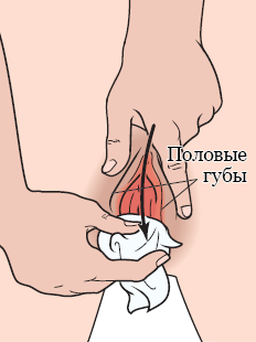 Рисунок 1.  Очистка области между половых губ