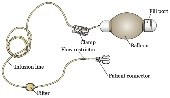 Continuous Infusion with Your Elastomeric Pump