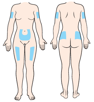 subcutaneous injection sites for injections