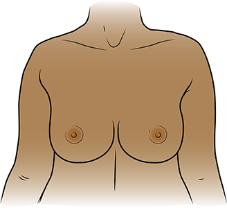 https://www.mskcc.org/sites/default/files/patient_ed/how_take_pictures_of_your_breasts_for_healthcare_provider-233011/take_pictures_breast-fig_1b.png