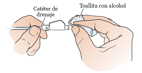 Figura 3. Limpie el extremo del catéter de drenaje