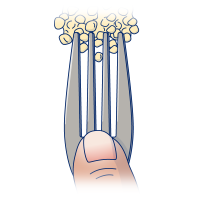 Figure 1. Fork test