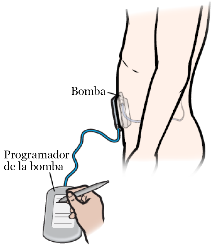 Figura 2. Programación de la bomba