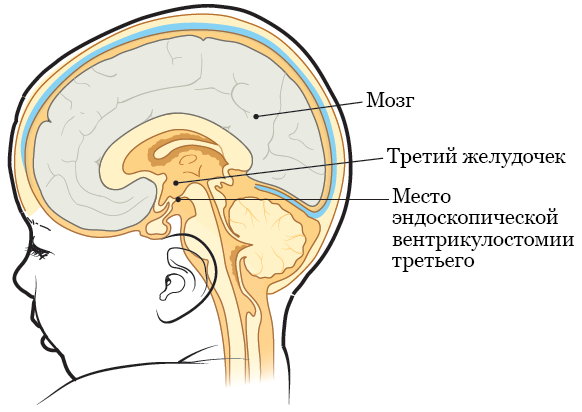 Рисунок 2.&nbsp; ETV