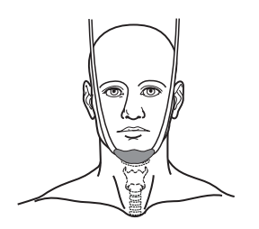 Рисунок 2.  Подбородочная повязка для радиотерапии