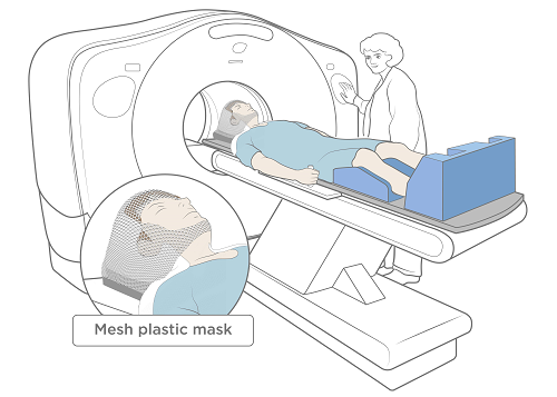 Рисунок 3.  Сканирование методом компьютерной томографии (computed tomography, CT) с размещенной на лице сеткой с отверстием