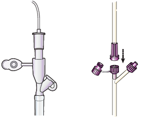 Рисунок 11.  Подсоедините трубку от мешка для питательной смеси к трубке для питания с соединителем старого образца (слева) или соединителем ENFit (справа)