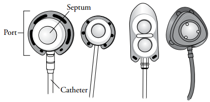 About Your Implanted Port | Memorial Sloan Kettering Cancer Center