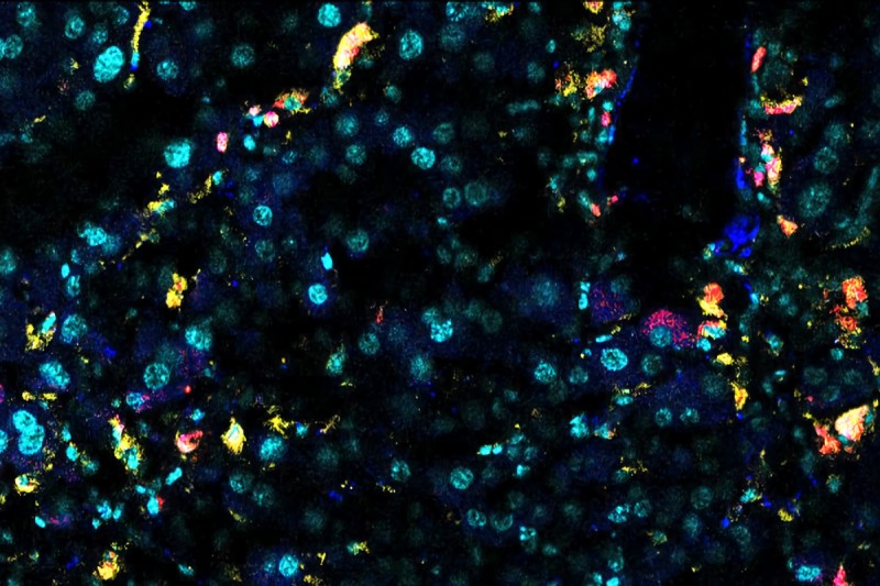 An immunofluorescence image of an aged mouse liver.