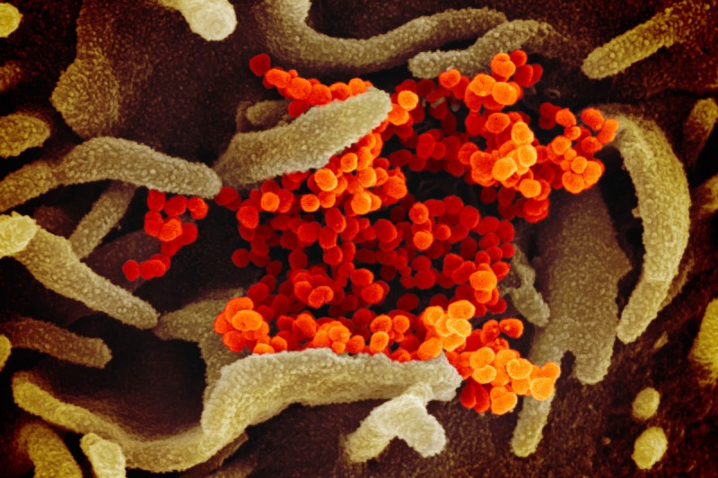 microscope image of the SARS-CoV-2 virus