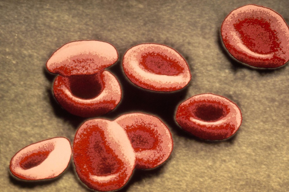 Research Points To A Potential New Approach For Treating Anemia ...