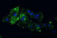 Stem cells induced to become cardiomyocytes