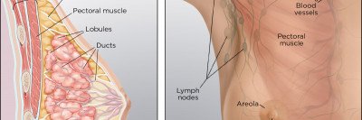 Breast Cancer Surgery Types