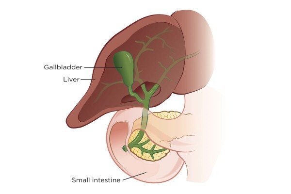 Types of Gallbladder Cancer | Memorial Sloan Kettering Cancer Center