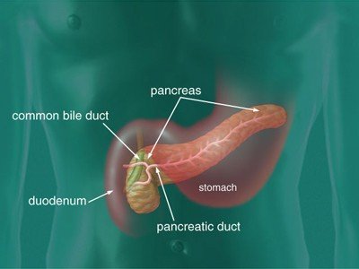 Pancreatic Cysts | Memorial Sloan Kettering Cancer Center