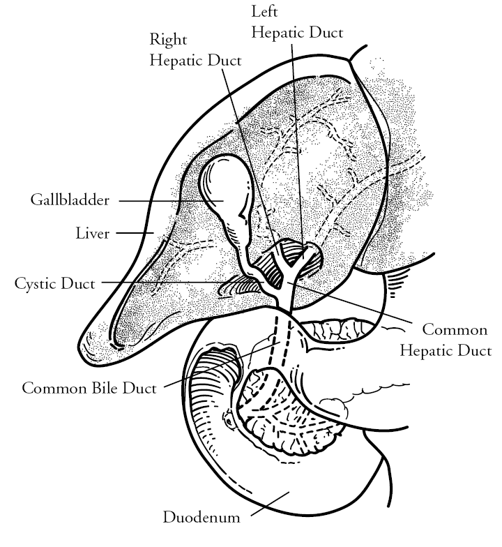 Operations to Treat Tumors of the Bile Duct | Memorial Sloan Kettering ...